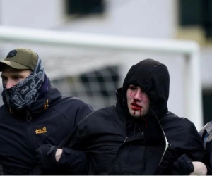 Beerschot-fan die veld betrad wel héél hardhandig aangepakt door politie: schedelbreuk en verbrijzelde oogkas 